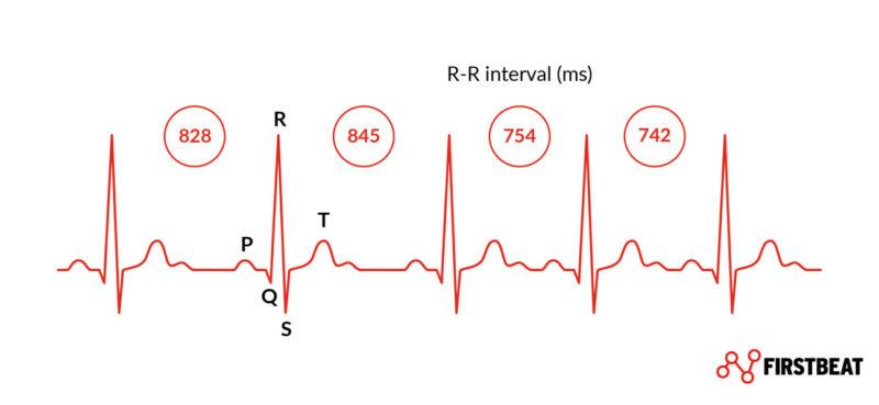 Heart Rate Variability (HRV) - Firstbeat Science